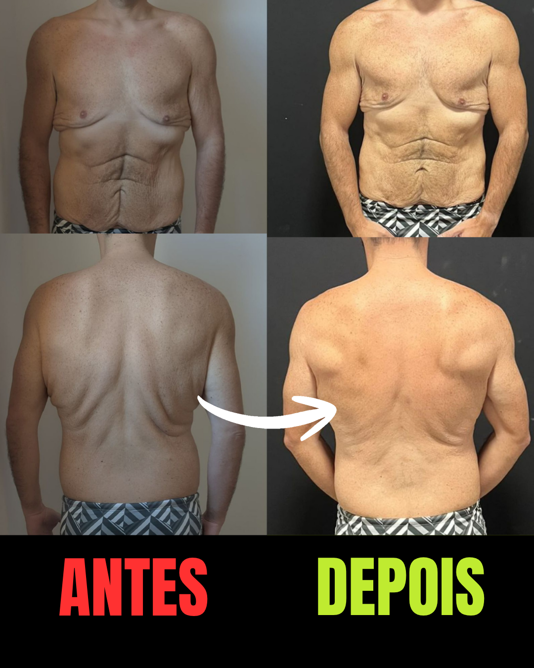 Resultado real de aluno bariátrico